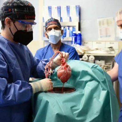 Surgeon transplant